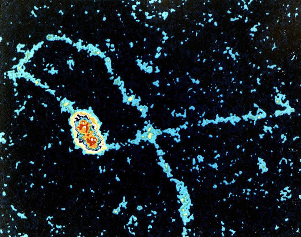 Electron micrograph of SV40 viral DNA replication. U.S. Department of Energy, public domain.