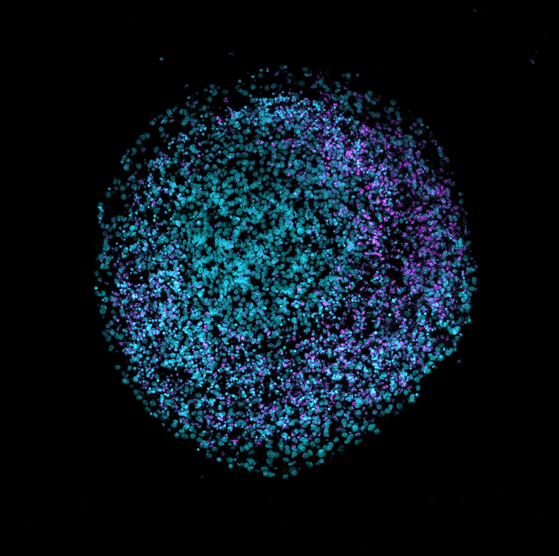 Human brain organoid observed using fluorescence microscopy. Cell nuclei appear in cyan and magenta. Image: Nreis1, CC BY 4.0, Wikimedia Commons.