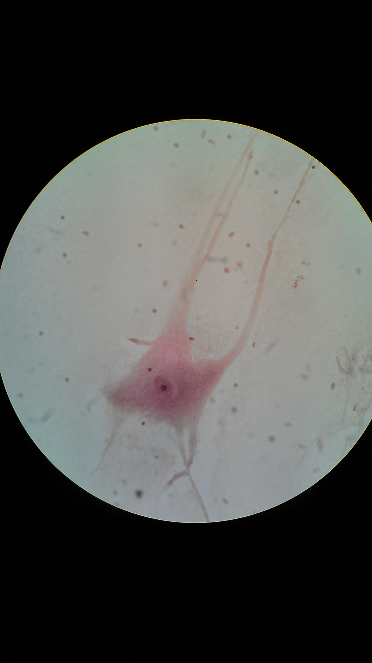 Neuron viewed under a microscope. Photo: Kevronichebroni, CC BY-SA 3.0.